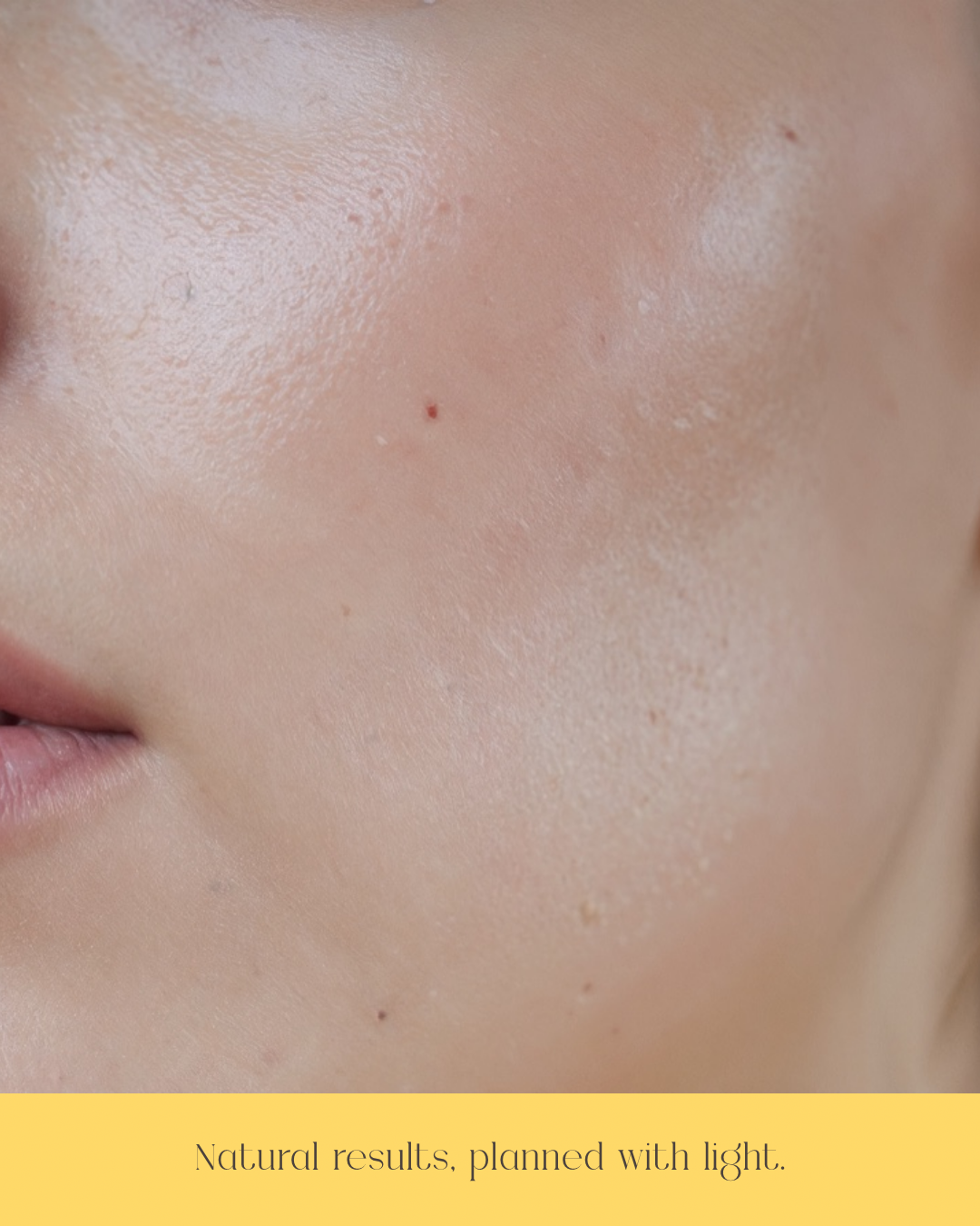 Skin photography with caption