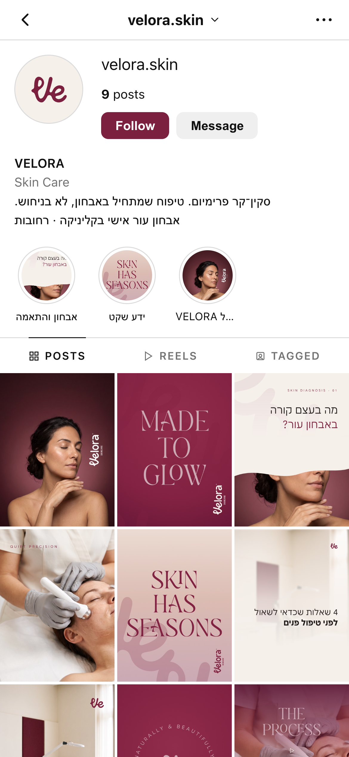צילום מלא של פרופיל VELORA העובד, כולל ביו, היילייטס וגריד
